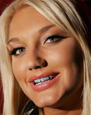 Name:  brooke-hogan-grillz2.jpg
Views: 161
Size:  21.5 KB