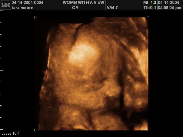 Name:  BABY_BOY_22__FACE.jpg
Views: 184
Size:  26.3 KB