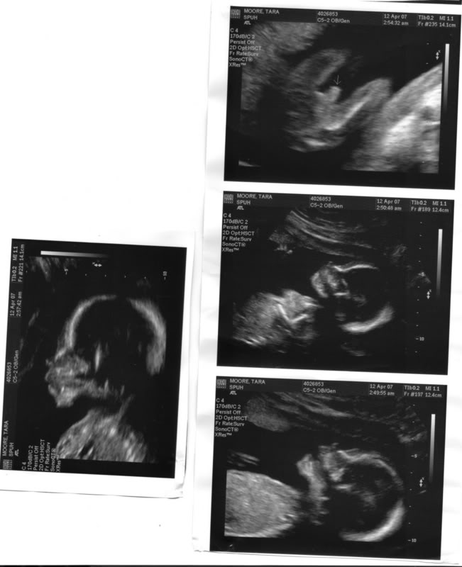 Name:  tylersbabybrother.jpg
Views: 49
Size:  50.9 KB